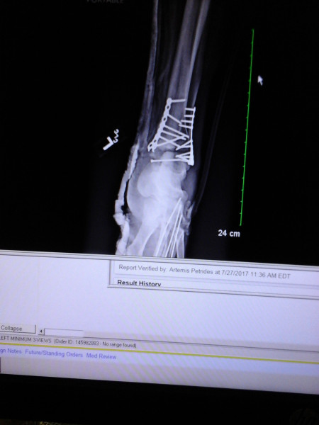 Broken_Gothic-gamer_girl