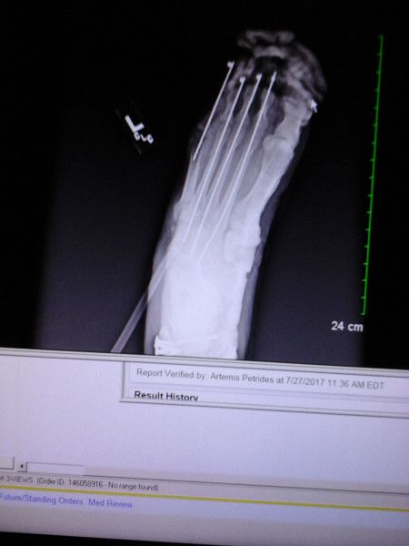 Broken_Gothic-gamer_girl