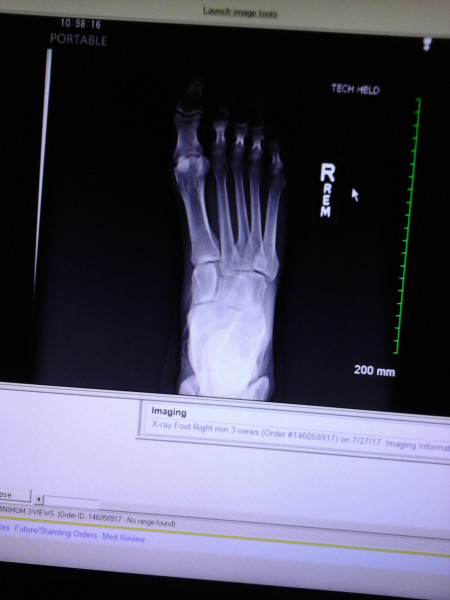 Broken_Gothic-gamer_girl