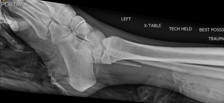 Broken_Gothic-gamer_girl