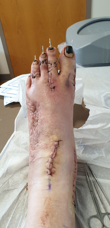 Broken_Gothic-gamer_girl